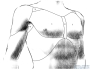 Regiones Pectorales * Regiones Pectorales
1 - Regio pectoralis,
2 - Regio praesternalis,
3 - Trigonum clavipectorale,
4 - Regio axillaris.
The regions of the chest (Regiones pectorales of the Thorax) are marked by the following borders:
The upper border is formed by the Clavicula (collarbone), the Regio deltoidea above the Musculus deltoideus (the side border), and the Arcus costalis (the curve of the lowest ribs) at the bottom. Due to the different sexual characteristics, the regions of the chest are different in females and males.

Regio praesternalis above the Sternum (breastbone) exists in both female and male individuals. Regio pectoralis is located on both sides of this area, marked by the Musculus pectoralis major (large breast muscle; origin at Clavicula, sides of Sternum and the first 4-6 ribs; insertion at the upper part of Humerus= upper arm). To the side of this region, there is the area of the armpit (Regio axillaris), located between the Regio pectoralis and the upper arm.
Trigonum clavipectorale is a triangular area, marked by Regio deltoidea (Area above the Musculus deltoideus; origin at Scapula and Clavicula; insertion at Humerus), Regio pectoralis and Clavicula. 
Female individuals have a Regio mammaria above the lower parts of Regio pectoralis, marked by the breast borders. 
The back of the Thorax is divided into three regions, a Regio vertebralis above the spinal column (Columna vertebralis), Regio scapularis above the Scapula, and Regio subscapularis between Regio scapularis, vertebralis and the last ribs.